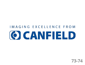Canfield